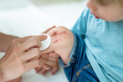 pirmoji pagalba namuose